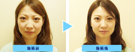 ���e�I�R�����g